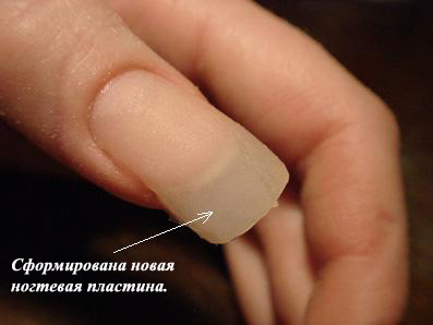 Ожог ногу кипятком лечение в домашних условиях